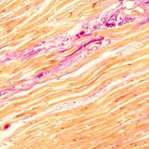 Picrofuchsin Van Gieson